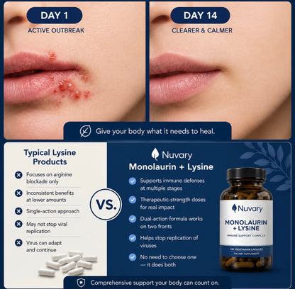 Monolaurin +Lysine Antiviral Capsules